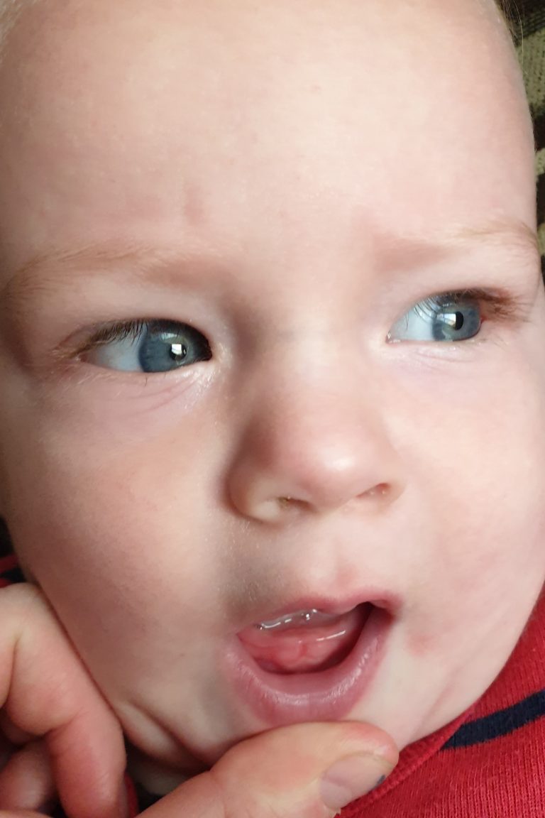 Is My Baby Teething?! Why I Took 1,682 Pictures of My Baby's Gums ...